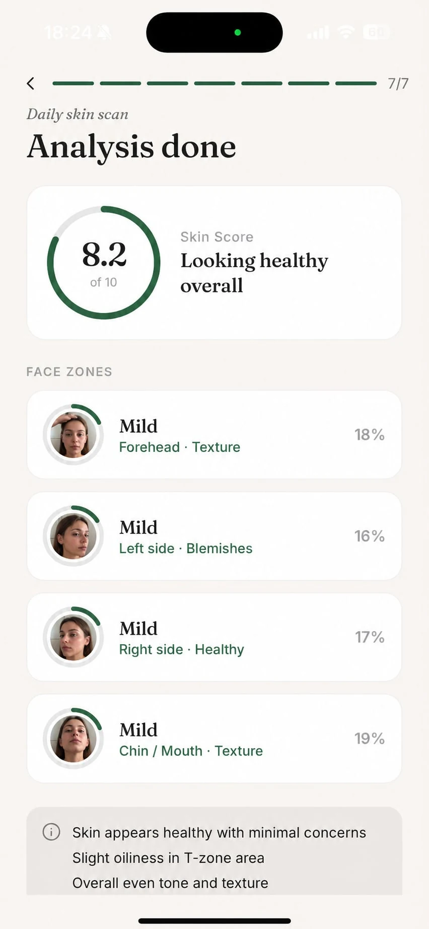Aperia skin score by zone